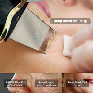 🎉2023 Beauty Sale 30% Off - Electric Skin Scrubber Blackhead Remover